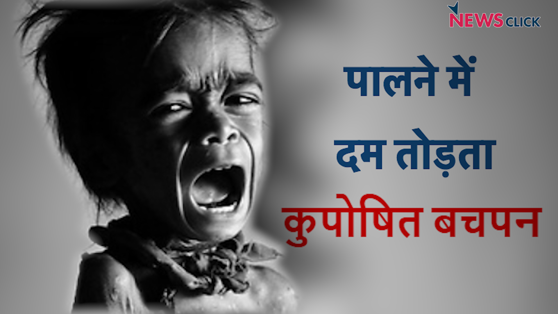  malnutrition 