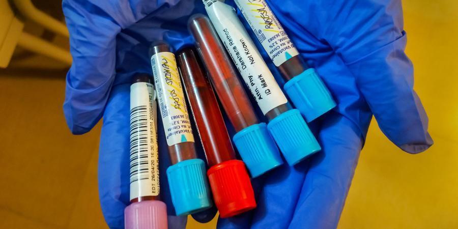 coronavirus