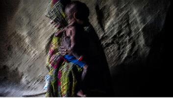 global hunger index