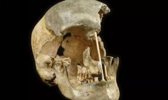 Human skeleton